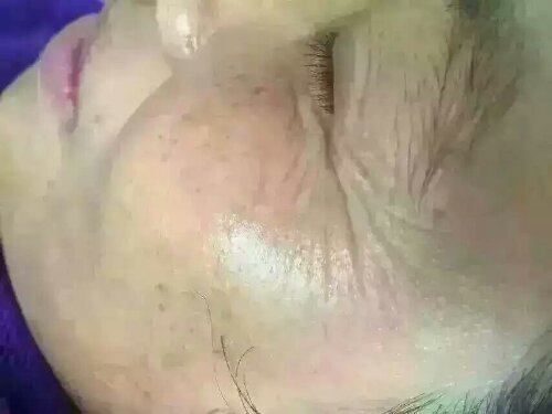 mmexport1457528363969.jpg